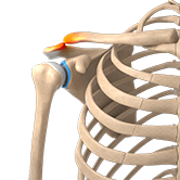 Acromioclavicular (AC) Joint Injuries Image