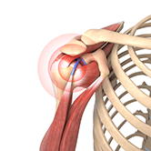 Baseball and Shoulder Injuries Image