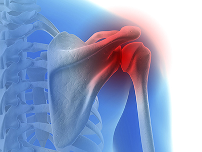 Baseball & Shoulder Injuries - Educational Picture
