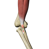 Biceps Tendon Repair Image
