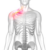 Burners and Stingers Image