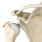 Dislocated Shoulder Image