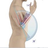 Elbow Contracture Image
