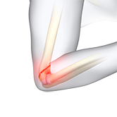 Elbow Fracture Reconstruction Image