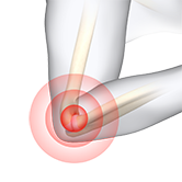 Elbow Injuries Image