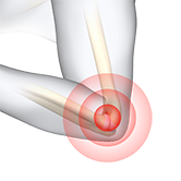 Elbow Pain Image