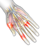 Finger & Thumb Sprains Image