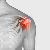 Frozen Shoulder Image