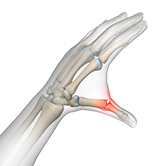 Gamekeeper's Thumb Image