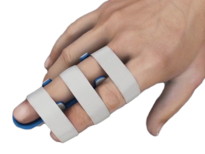 Hand Fracture Care - Educational Picture