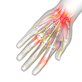 Hand Injuries and Conditions Image