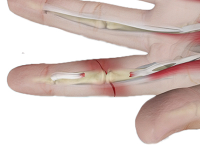Hand Injuries and Conditions - Educational Picture