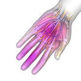 Hand Numbness Image