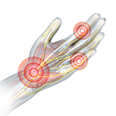 Hand Pain Image