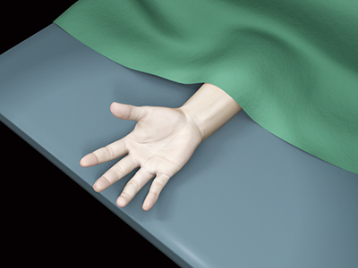 Hand Surgery - Educational Picture