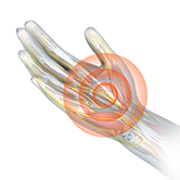 Hand Therapy Image