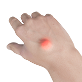 Hand Tumors Image