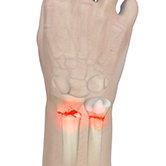 Hand & Wrist Fractures Image