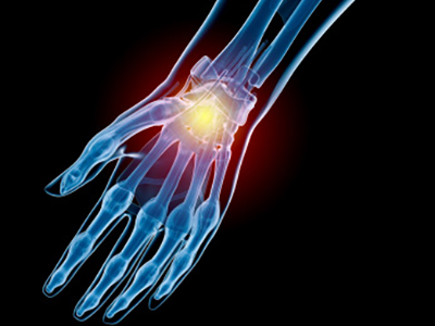 Hand and Wrist Sports Injuries - Educational Picture