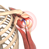 Rotator Cuff Pain Image