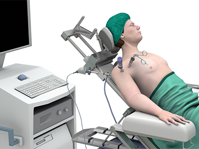 Shoulder Arthroscopy - Educational Picture