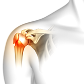 Shoulder Fracture Care Image
