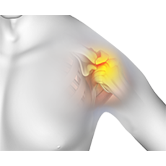 Shoulder Impingement Image