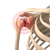 Shoulder Pain Image