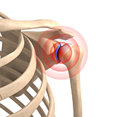 Shoulder Trauma Image
