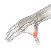 Skier's Thumb Image