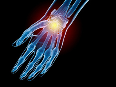 Sports Injury Management of Hand, Wrist and Elbow - Educational Picture