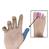 Toe to Hand Transfer Image
