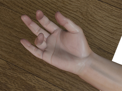 Trigger Finger - Educational Picture