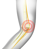 Ulnar Nerve Release Image