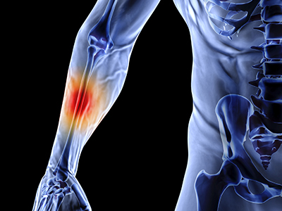 Work Related Hand Injuries - Educational Picture