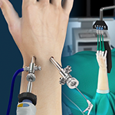 Wrist Arthroscopy Image
