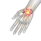 Wrist Injuries and Conditions Image