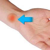 Wrist Tumors Image