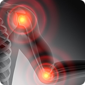 Arthritis Image